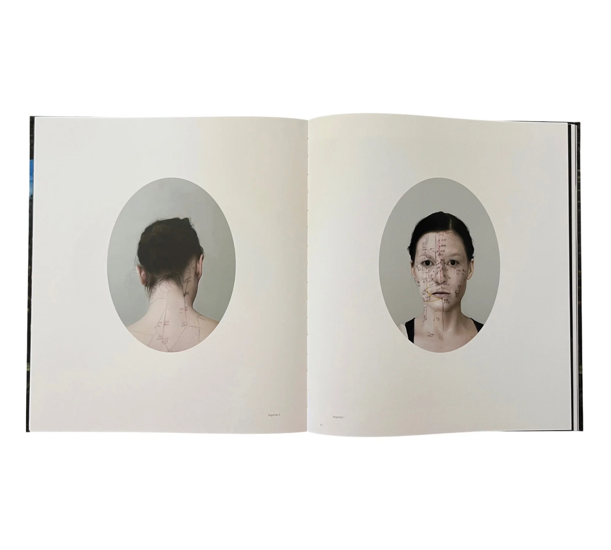 Lovisa Ringborg: Phantom Limbs - Image 7